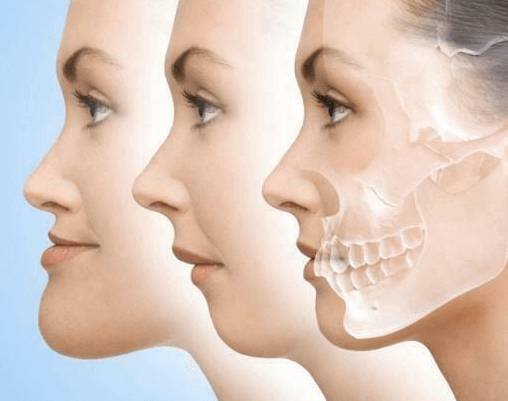 Cirurgia bucomaxilofacial — Ratton Odontologia