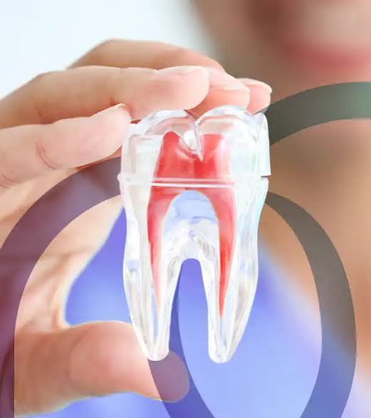 Endodontia — Ratton Odontologia