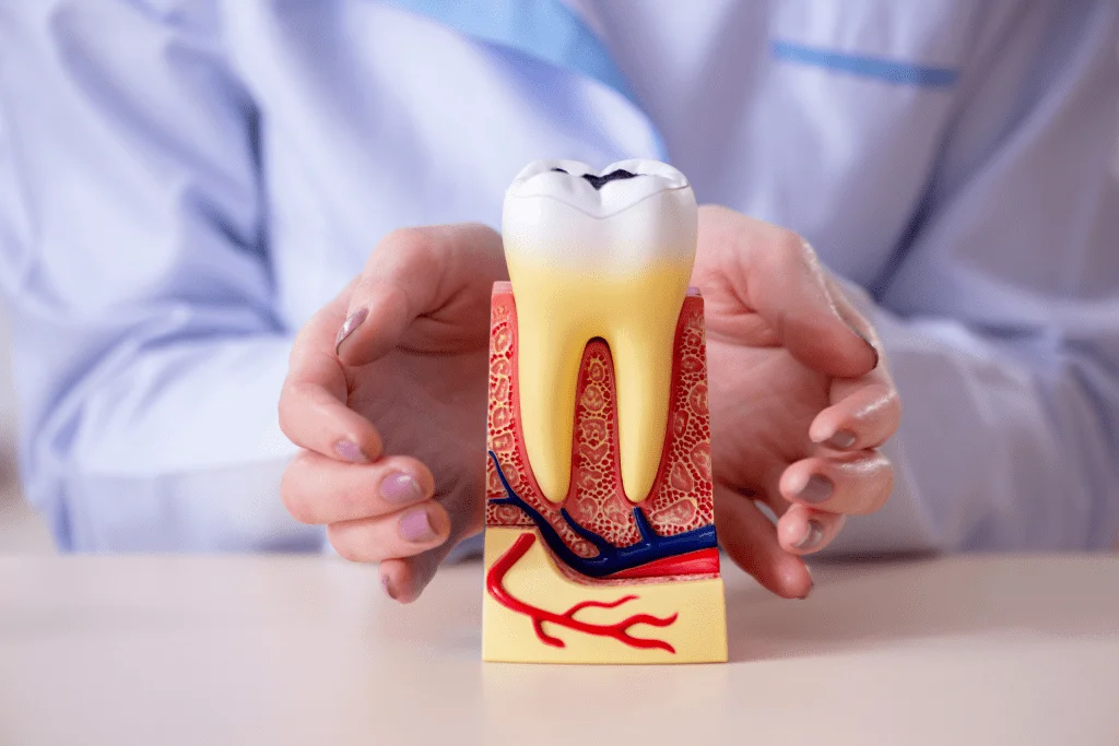 Periodontia — Ratton Odontologia